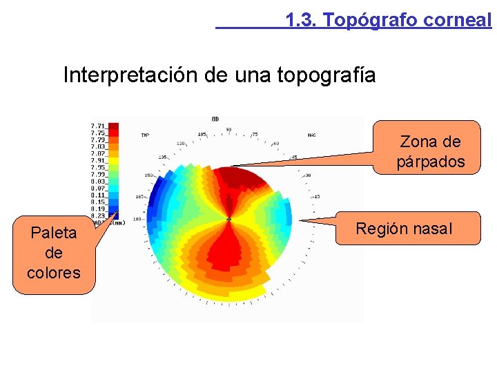 1. 3. Topógrafo corneal Interpretación de una topografía Zona de párpados Paleta de colores 1. 3. Topógrafo corneal Interpretación de una topografía Zona de párpados Paleta de colores