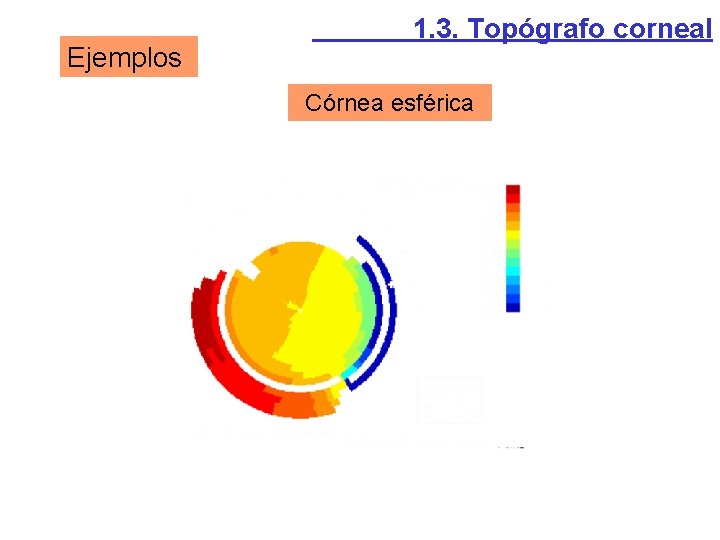 Ejemplos 1. 3. Topógrafo corneal Córnea esférica Ejemplos 1. 3. Topógrafo corneal Córnea esférica