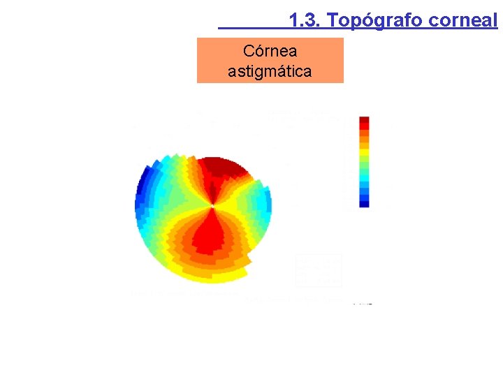 1. 3. Topógrafo corneal Córnea astigmática 1. 3. Topógrafo corneal Córnea astigmática
