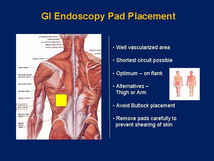 GI Endoscopy Pad Placement • Well vascularized area • Shortest circuit possible • Optimum