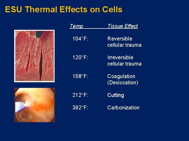 ESU Thermal Effects on Cells Temp Tissue Effect 104°F: Reversible cellular trauma 120°F: Irreversible