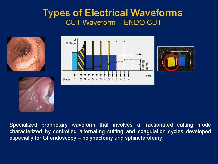Types of Electrical Waveforms CUT Waveform – ENDO CUT Specialized proprietary waveform that involves