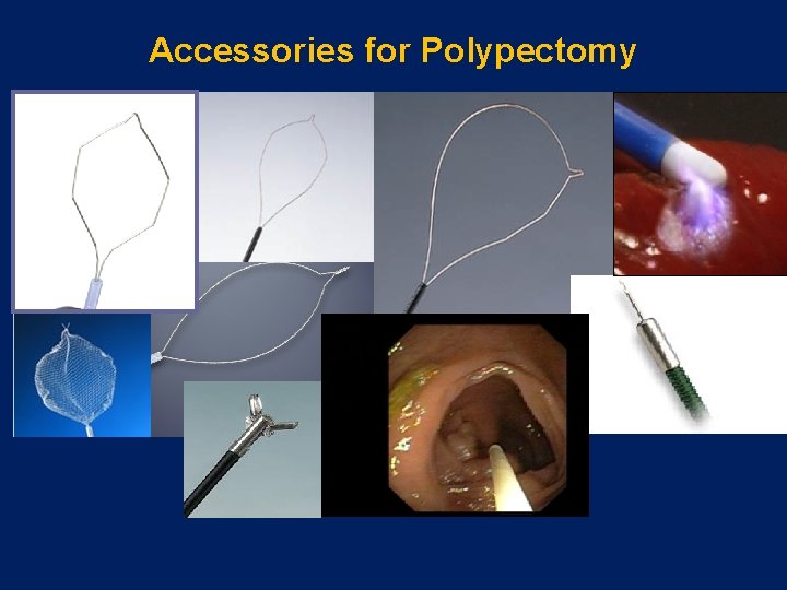Accessories for Polypectomy 