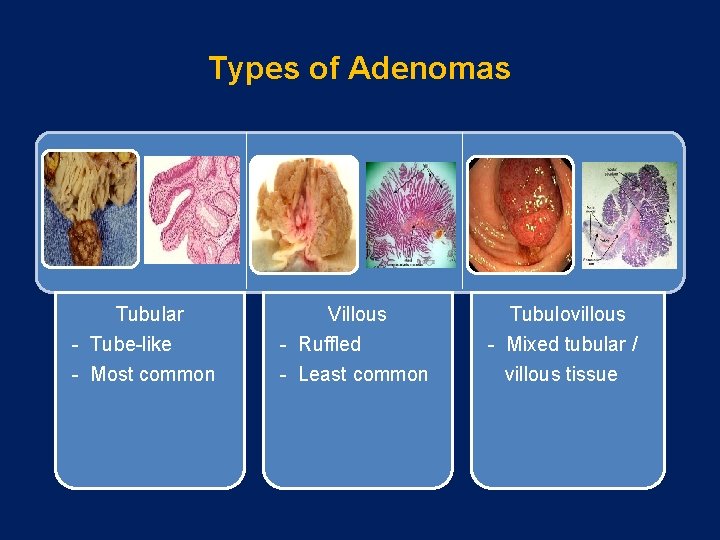 Types of Adenomas Tubular - Tube-like - Most common Villous - Ruffled - Least