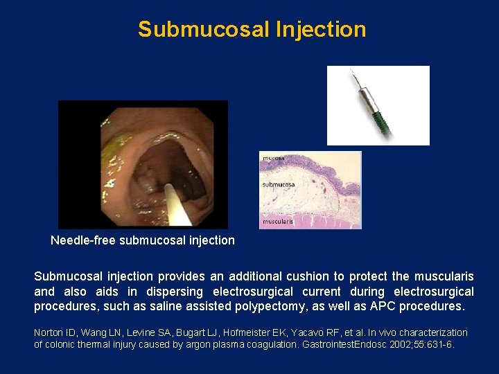 Submucosal Injection Needle-free submucosal injection Submucosal injection provides an additional cushion to protect the