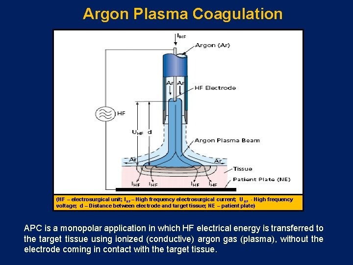 Argon Plasma Coagulation (HF – electrosurgical unit; IHF – High frequency electrosurgical current; UHF
