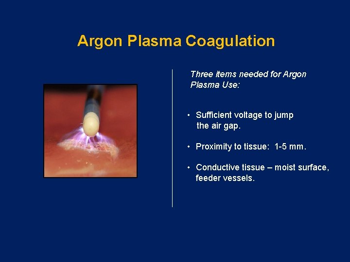 Argon Plasma Coagulation Three items needed for Argon Plasma Use: • Sufficient voltage to