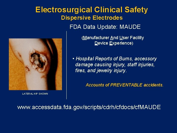 Electrosurgical Clinical Safety Dispersive Electrodes FDA Data Update: MAUDE (Manufacturer And User Facility Device