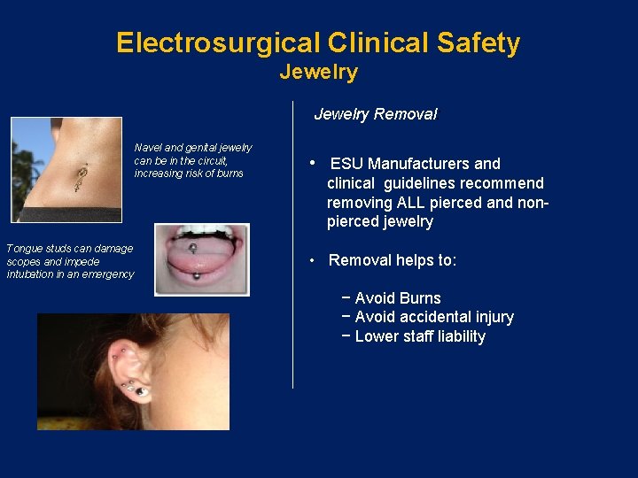 Electrosurgical Clinical Safety Jewelry Removal: Navel and genital jewelry can be in the circuit,