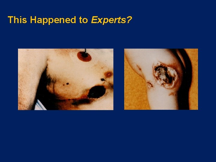 This Happened to Experts? 