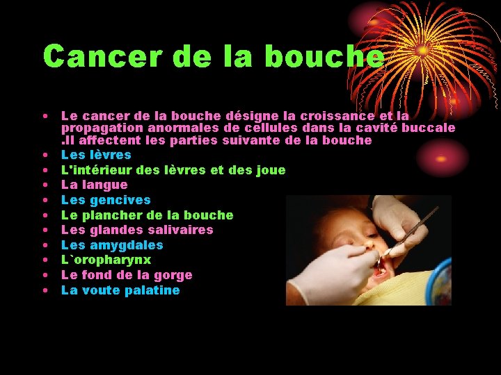 Cancer de la bouche • Le cancer de la bouche désigne la croissance et