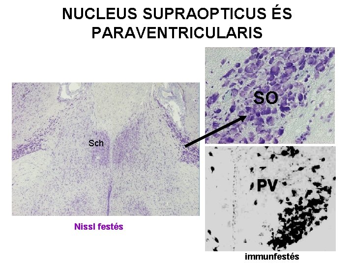 NUCLEUS SUPRAOPTICUS ÉS PARAVENTRICULARIS SO Sch Nissl festés immunfestés 