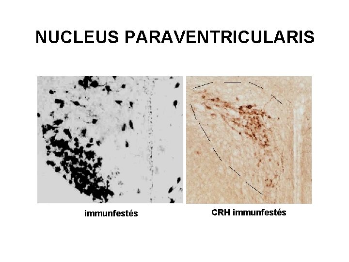 NUCLEUS PARAVENTRICULARIS III. agykamra immunfestés III. agykamra CRH immunfestés 