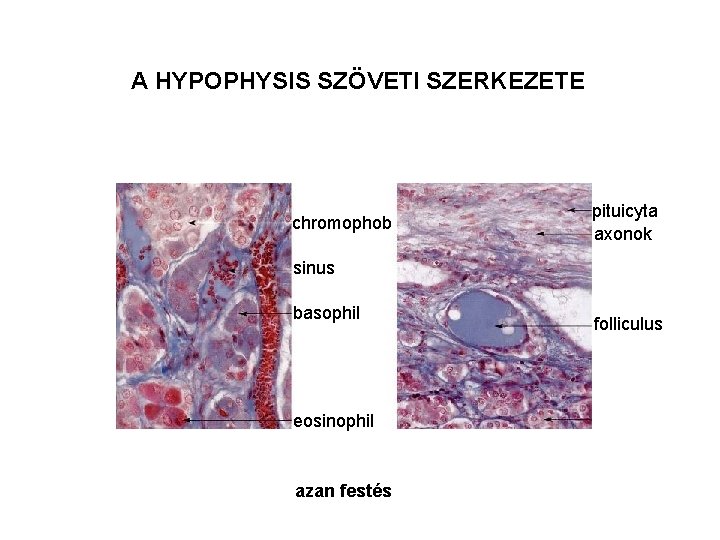 A HYPOPHYSIS SZÖVETI SZERKEZETE chromophob pituicyta axonok sinus basophil eosinophil azan festés folliculus 