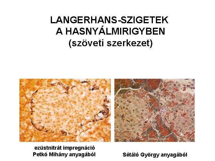 LANGERHANS-SZIGETEK A HASNYÁLMIRIGYBEN (szöveti szerkezet) ezüstnitrát impregnáció Petkó Mihány anyagából Sétáló György anyagából 