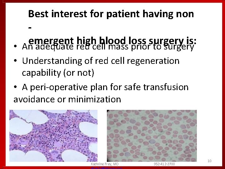 Best interest for patient having non emergent high blood loss surgery is: • An Best interest for patient having non emergent high blood loss surgery is: • An