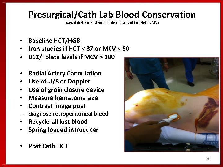 Presurgical/Cath Lab Blood Conservation (Swedish Hospital, Seattle slide courtesy of Lori Heller, MD) • Presurgical/Cath Lab Blood Conservation (Swedish Hospital, Seattle slide courtesy of Lori Heller, MD) •