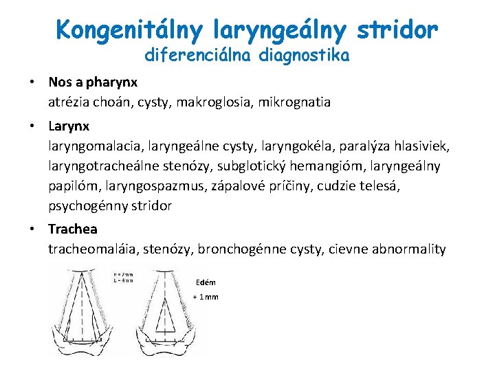 Kongenitálny laryngeálny stridor diferenciálna diagnostika • Nos a pharynx atrézia choán, cysty, makroglosia, mikrognatia