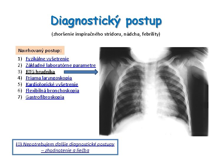 Diagnostický postup (zhoršenie inspiračného stridoru, nádcha, febrility) Navrhovaný postup: 1) 2) 3) 4) 5)