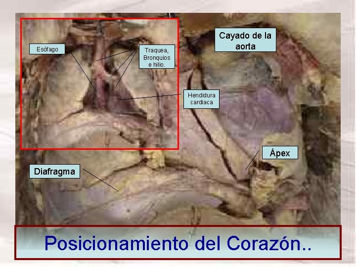 Esófago Cayado de la aorta Traquea, Bronquios e hilio. Cara Anterior Hendidura cardiaca Ápex Esófago Cayado de la aorta Traquea, Bronquios e hilio. Cara Anterior Hendidura cardiaca Ápex