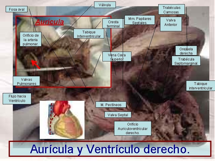Válvula Trabéculas Carnosas. Fosa oval Aurícula Orificio de la arteria pulmonar. Cresta terminal Mm. Válvula Trabéculas Carnosas. Fosa oval Aurícula Orificio de la arteria pulmonar. Cresta terminal Mm.