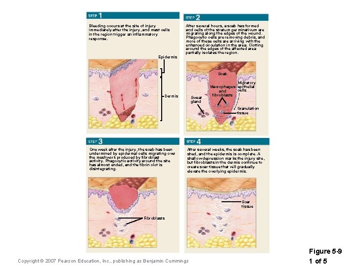 Bleeding occurs at the site of injury immediately after the injury, and mast cells Bleeding occurs at the site of injury immediately after the injury, and mast cells