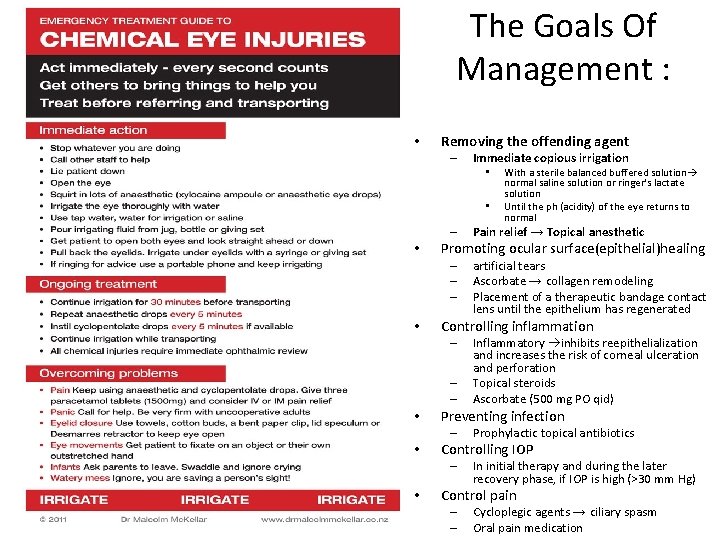 The Goals Of Management : • Removing the offending agent – Immediate copious irrigation The Goals Of Management : • Removing the offending agent – Immediate copious irrigation