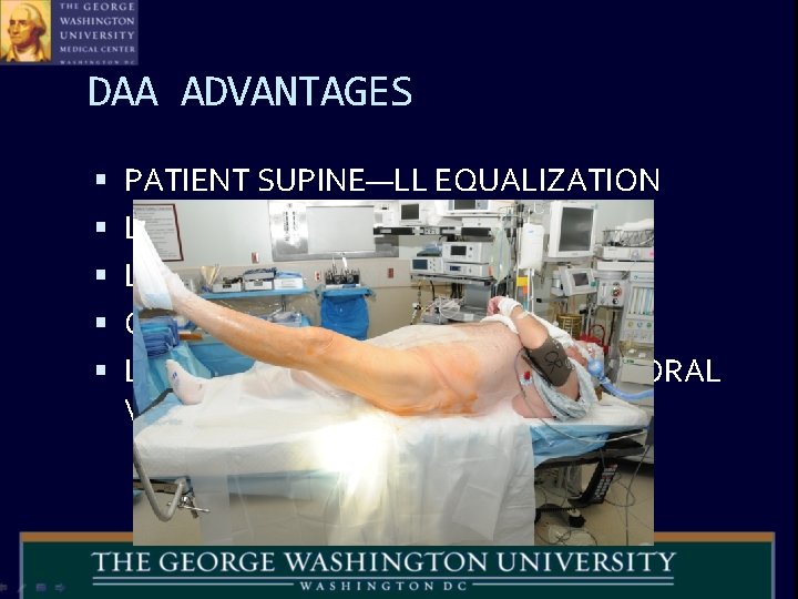 DAA ADVANTAGES PATIENT SUPINE—LL EQUALIZATION LOWER DISLOCATION RATE LESS INVASIVE ? OBESE PATIENTS EASIER