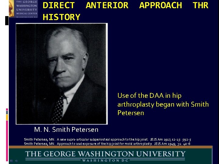 DIRECT ANTERIOR HISTORY APPROACH THR Use of the DAA in hip arthroplasty began with