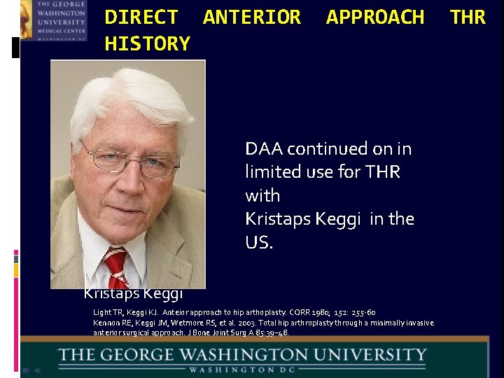 DIRECT ANTERIOR HISTORY APPROACH DAA continued on in limited use for THR with Kristaps