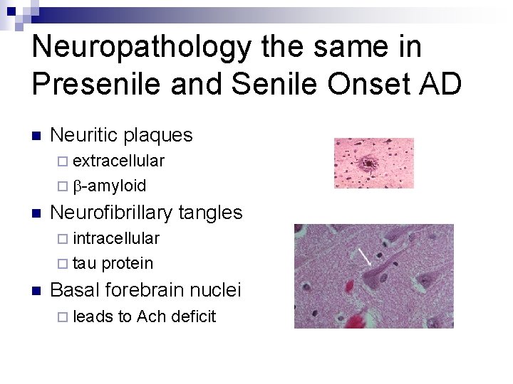 Neuropathology the same in Presenile and Senile Onset AD n Neuritic plaques ¨ extracellular
