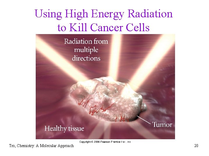 Using High Energy Radiation to Kill Cancer Cells Tro, Chemistry: A Molecular Approach 20
