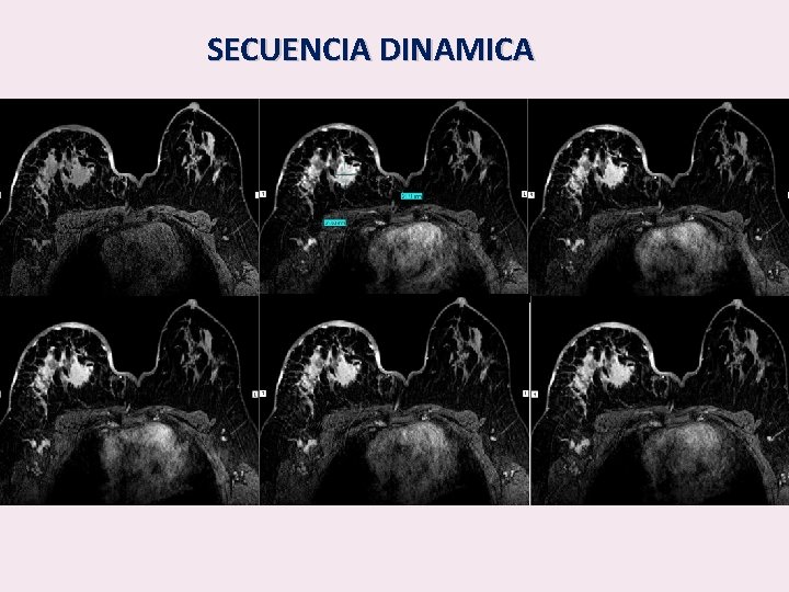 SECUENCIA DINAMICA 