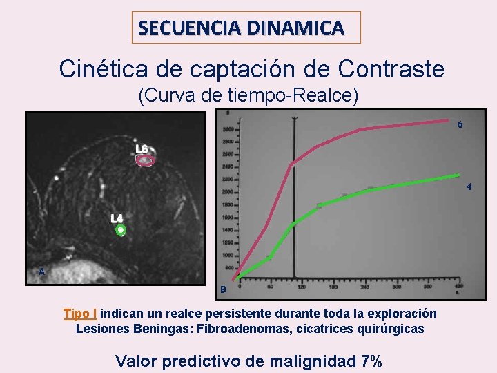 SECUENCIA DINAMICA Cinética de captación de Contraste (Curva de tiempo-Realce) 6 4 A B