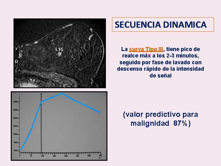 SECUENCIA DINAMICA La curva Tipo III, tiene pico de realce máx a los 2