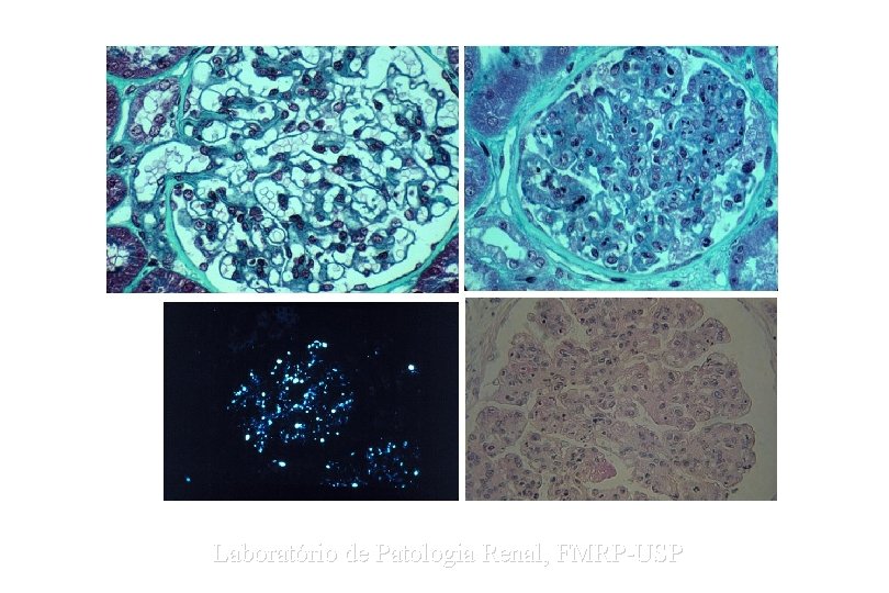 Laboratório de Patologia Renal, FMRP-USP 