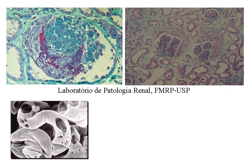 Laboratório de Patologia Renal, FMRP-USP 