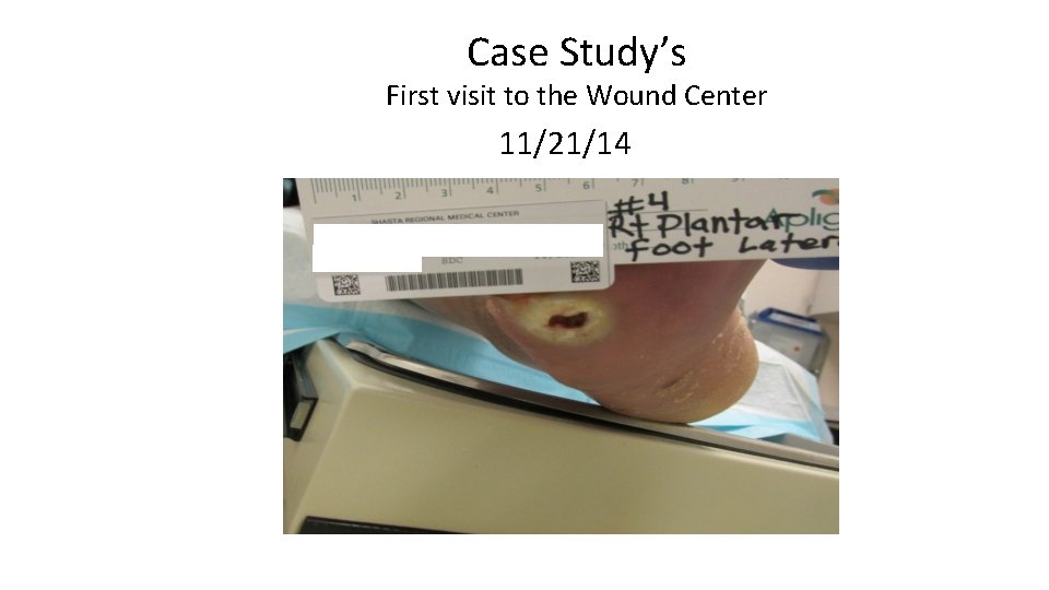 Case Study’s First visit to the Wound Center 11/21/14 