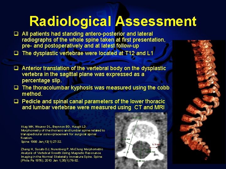 Radiological Assessment q All patients had standing antero-posterior and lateral radiographs of the whole