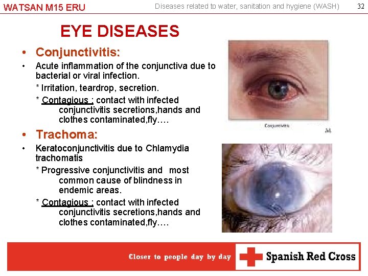 WATSAN M 15 ERU Diseases related to water, sanitation and hygiene (WASH) EYE DISEASES