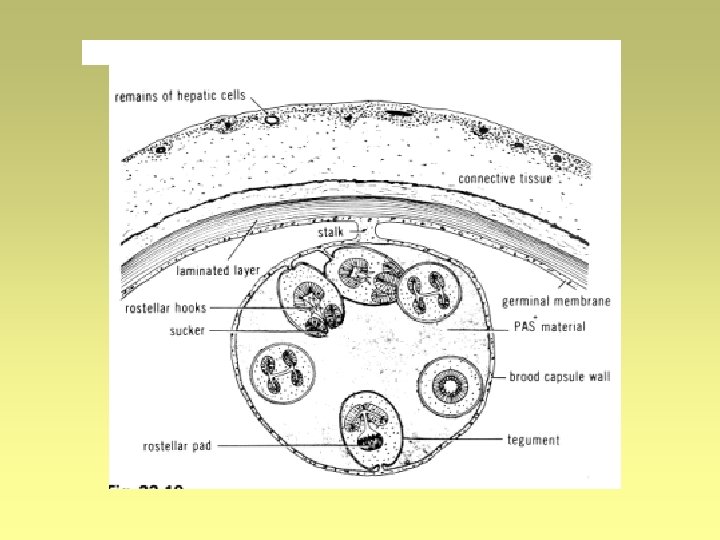 Syncytial tegument platyhelminthes - educato.hu