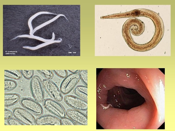 Paraziták, élősködők, férgek Enterobius vermicularis férgek