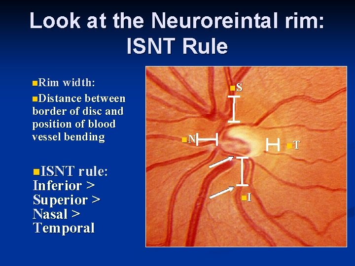 Look at the Neuroreintal rim: ISNT Rule n. Rim width: n. S n. Distance