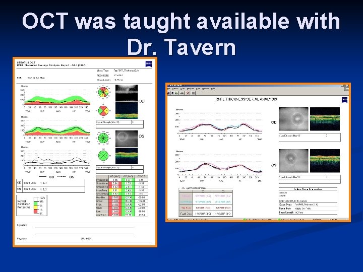 OCT was taught available with Dr. Tavern 