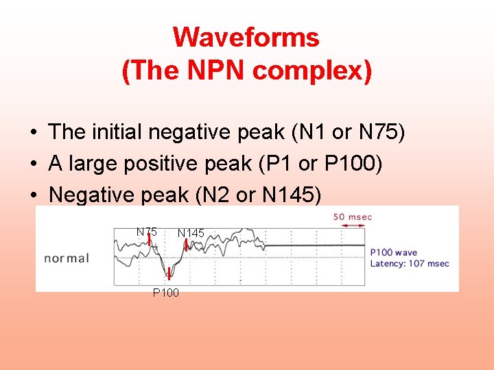 Waveforms (The NPN complex) • The initial negative peak (N 1 or N 75)