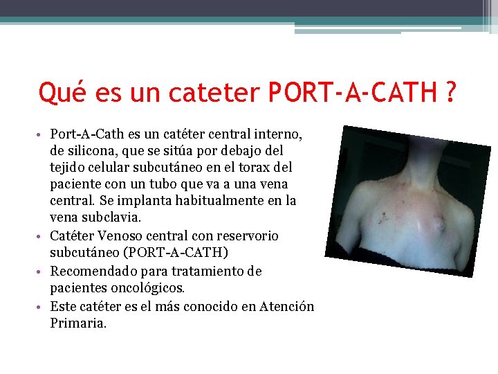 Qué es un cateter PORT-A-CATH ? • Port-A-Cath es un catéter central interno, de