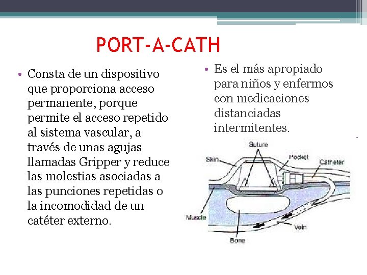 PORT-A-CATH • Consta de un dispositivo que proporciona acceso permanente, porque permite el acceso