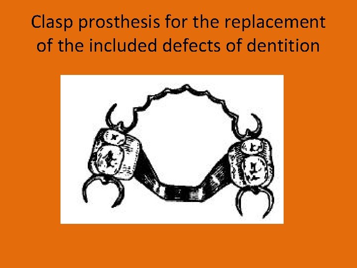 Clasp prosthesis for the replacement of the included defects of dentition 