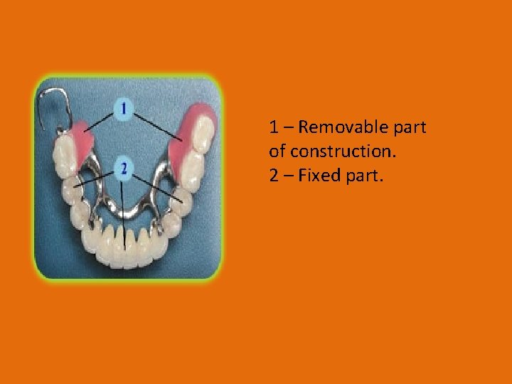 1 – Removable part of construction. 2 – Fixed part. 
