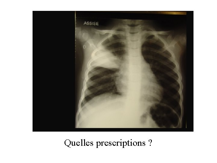 Quelles prescriptions ? 